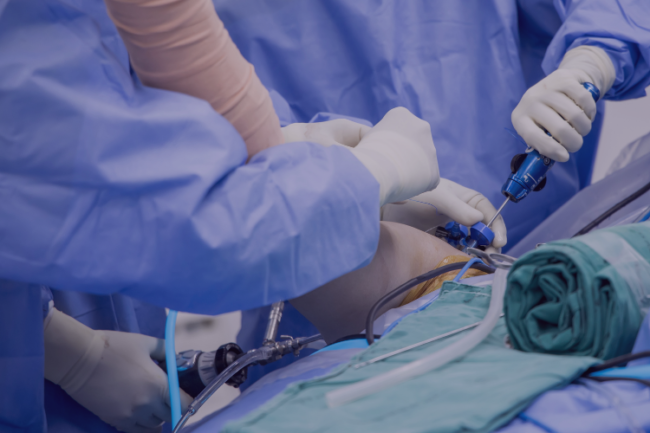 Arthroscopic Shoulder or Elbow Surgery Benefits Arthroscopic shoulder surgery