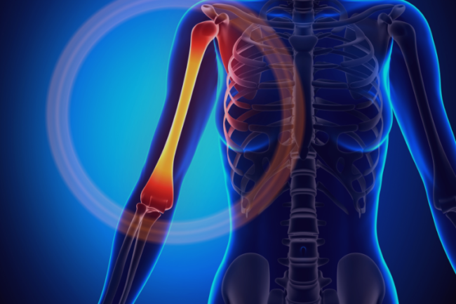 distal-humerus-fractures Distal humerus diagram